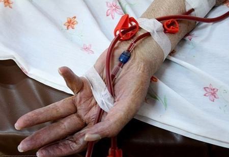 بیماری هموفیلی،اخبار پزشکی،خبرهای پزشکی