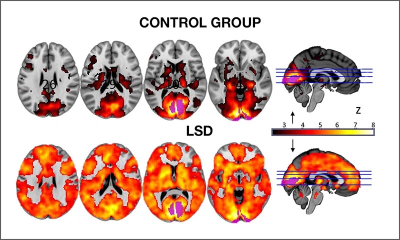 چطور مغزمان را از گذشته رها کنیم و آینده‌ای تازه بسازیم؟